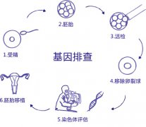 性别筛选-胎儿性别鉴定
